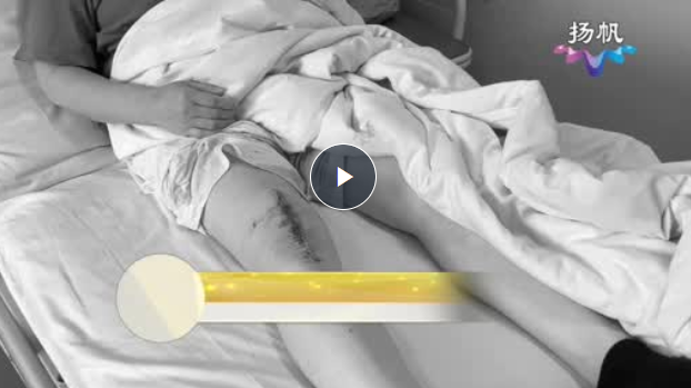 膝盖疼痛不能走 全膝置换手术来缓解【天天健康】